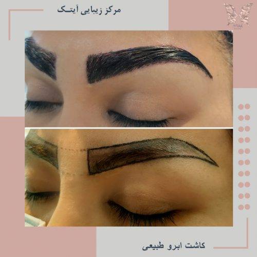 ماندگاری کاشت ابرو