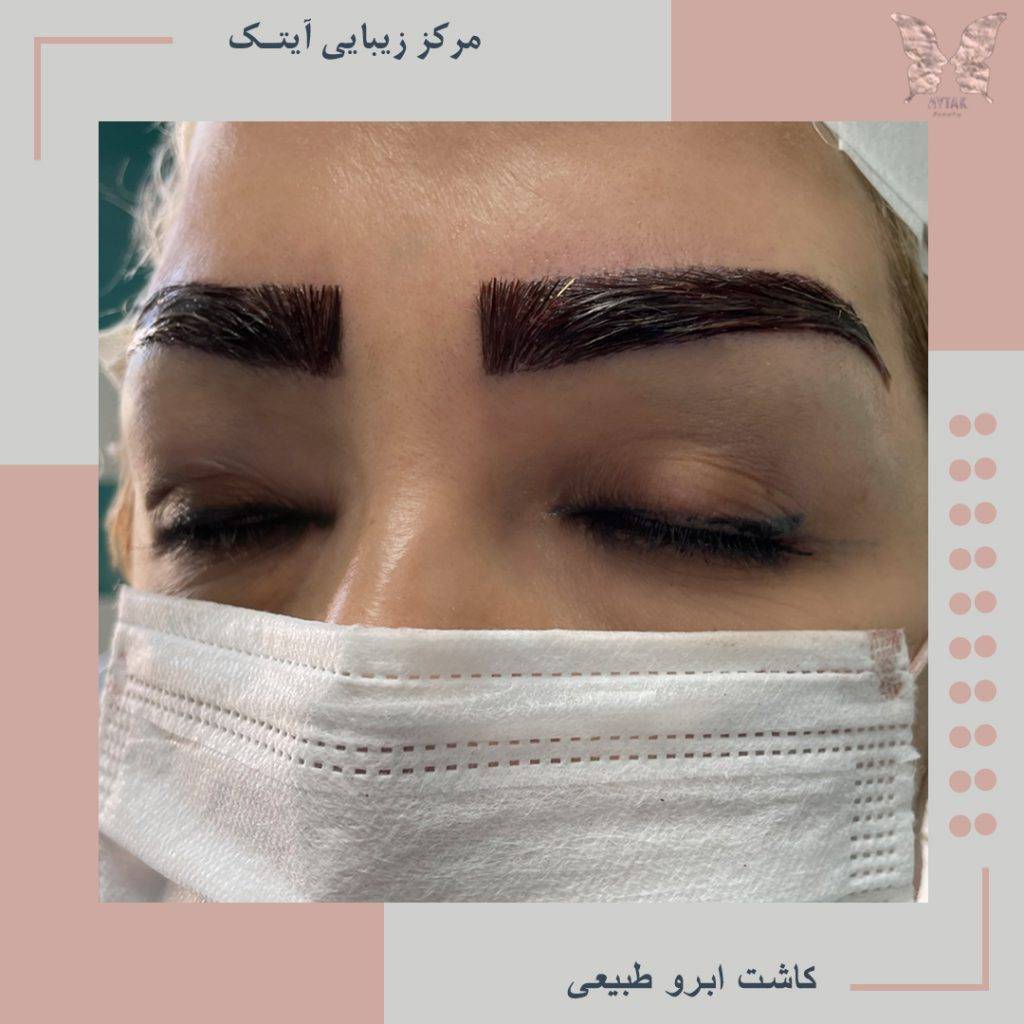 کاشت ابروی زنانه و طبیعی