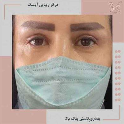 مرکز زیبایی آیتک