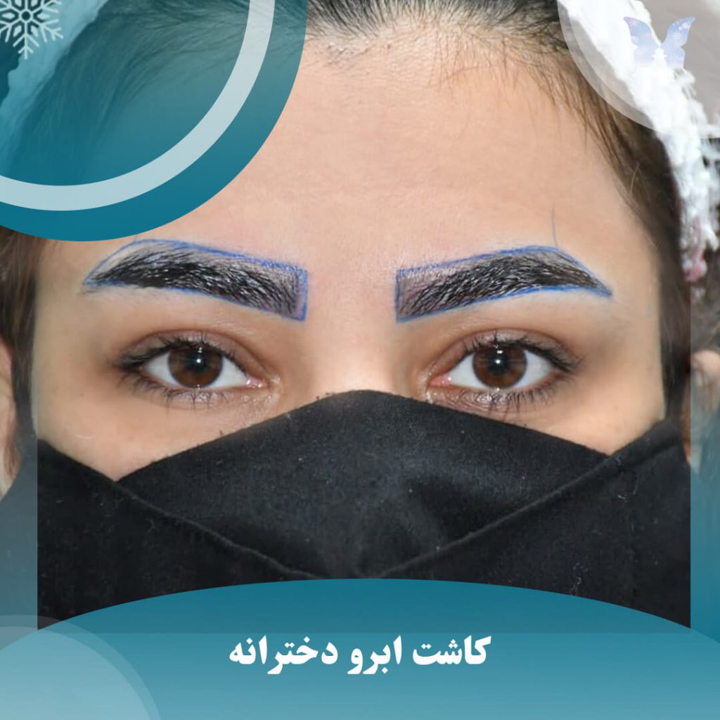 کاشت ابروی دخترونه