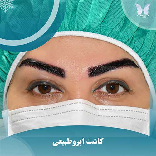 کاشت ابروی طبیعی و زیبا