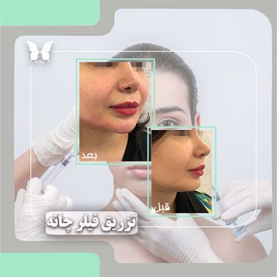 مرکز زیبایی آیتک