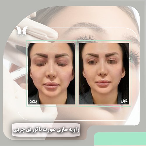 مرکز زیبایی آیتک