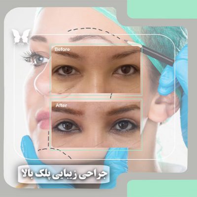 مرکز زیبایی آیتک