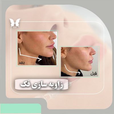 مرکز زیبایی آیتک