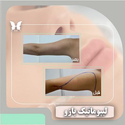 مرکز زیبایی آیتک