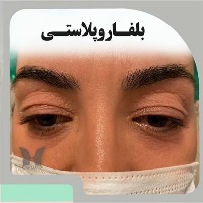 مرکز زیبایی آیتک