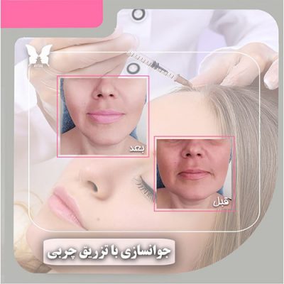 مرکز زیبایی آیتک